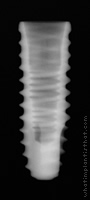 Radiograph of ET II