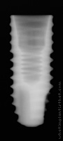Radiograph of ET II