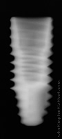 Radiograph of ET II