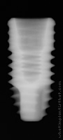 Radiograph of ET II