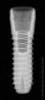 Radiograph of Aesthetica+2