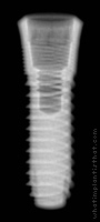 Radiograph of Aesthetica+2