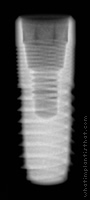 Radiograph of Aesthetica+2