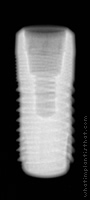 Radiograph of Aesthetica+2