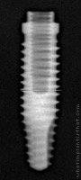Radiograph of Alvim