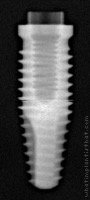 Radiograph of Alvim