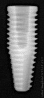 Radiograph of Alvim CM