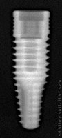 Radiograph of Alvim II Plus