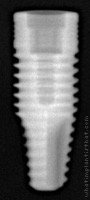 Radiograph of Alvim II Plus
