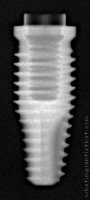 Radiograph of Alvim T I