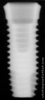 Radiograph of Osstem SSII