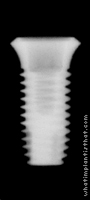 Radiograph of Osstem SSII