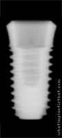 Radiograph of Osstem SSIII