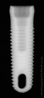 Radiograph of AdVent