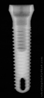 Radiograph of AdVent