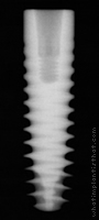 Radiograph of Friadent Ankylos C/X