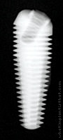 Radiograph of External Hex Co-Axis (Tapered)