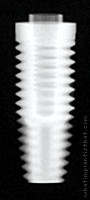 Radiograph of External Hex (Cylindrical)