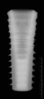 Radiograph of Implance | Bone Level 4.8