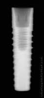 Radiograph of Implance | Bone Level 3.3