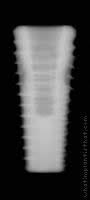 Radiograph of Implance | Bone Level 5.5