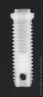 Radiograph of Branemark Mk I
