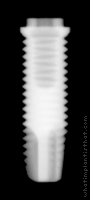 Radiograph of Branemark Mk III Groovy