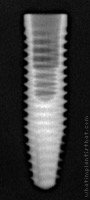 Radiograph of CM Alvim