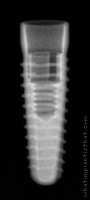Radiograph of Conelog Screw-Line
