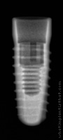 Radiograph of Conelog Screw-Line