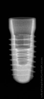 Radiograph of Conelog Screw-Line