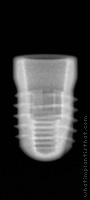 Radiograph of Conelog Screw-Line