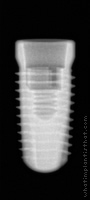 Radiograph of Conelog Screw-Line