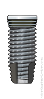 Radiograph of Connect RBM