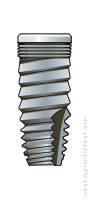 Radiograph of Connect SDS Tapered RBM
