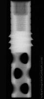 Radiograph of Core-Vent