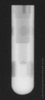 Radiograph of Cylinder-Line