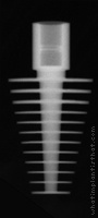 Radiograph of D Form