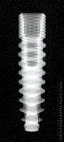 Radiograph of Deep Conical (Tapered)