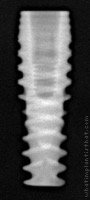Radiograph of Drive