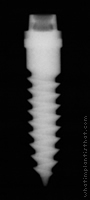 Radiograph of ERA Mini Dental Implants one-piece