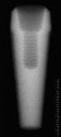 Radiograph of Endopore