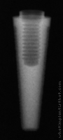 Radiograph of Endopore