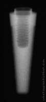 Radiograph of Endopore