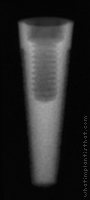 Radiograph of Endopore