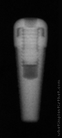 Radiograph of Endopore