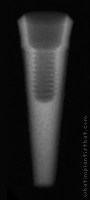Radiograph of Endopore