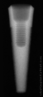 Radiograph of Endopore