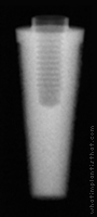 Radiograph of Endopore