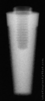 Radiograph of Endopore